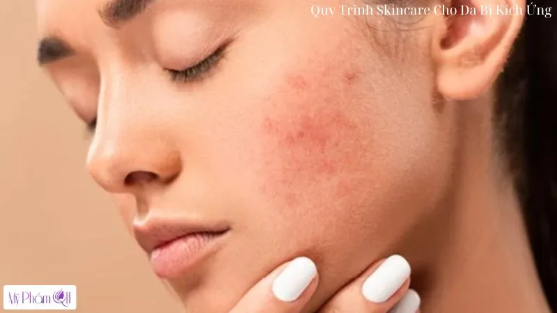 Quy Trình Skincare Cho Da Bị Kích Ứng