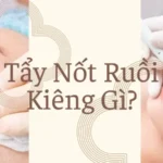 Tẩy Nốt Ruồi Kiêng Gì