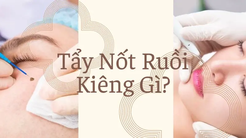 Tẩy Nốt Ruồi Kiêng Gì